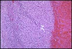 Corpus luteum of the ovary, medium power