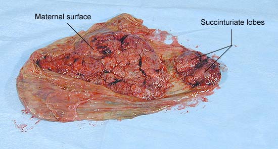 succinturiate lobes